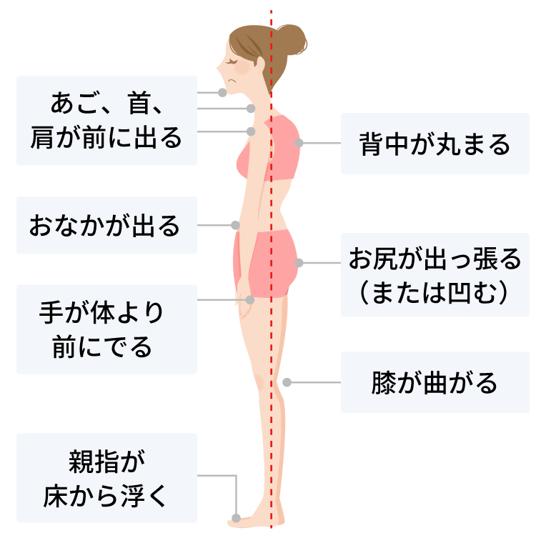 あご、首、肩が前に出る　背中が丸まる　おなかが出る　お尻が出っ張る（または凹む）　手が体より前に出る　膝が曲がる　親指が床から浮く